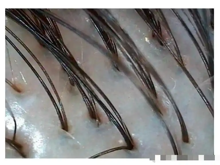 16615健康头皮状态呈藏青色,光亮润 - 抖音