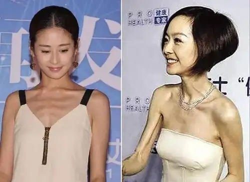 女生狂热追求「瘦」,是不是一种病态审美?