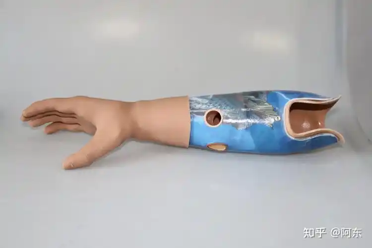 国内的肌电假肢智能仿生手好用吗跟国外相比有什么区别