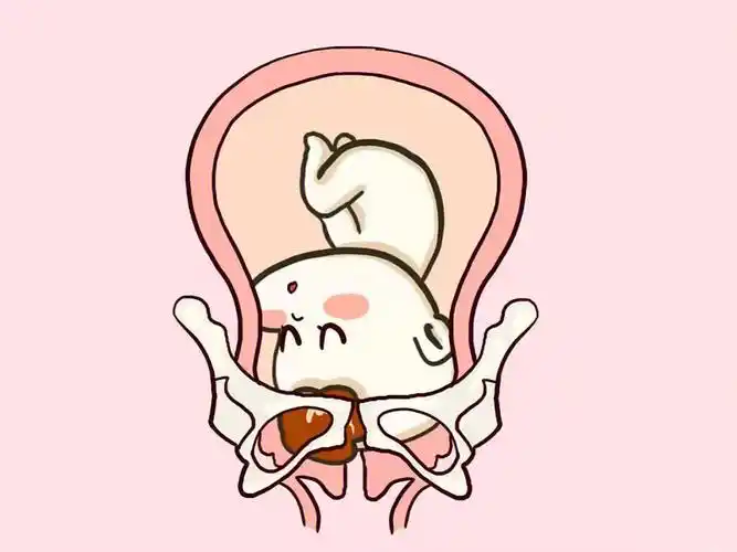 33周77宝宝入盆了