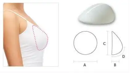 韩国ruby如妃整形外科医院水滴形胸