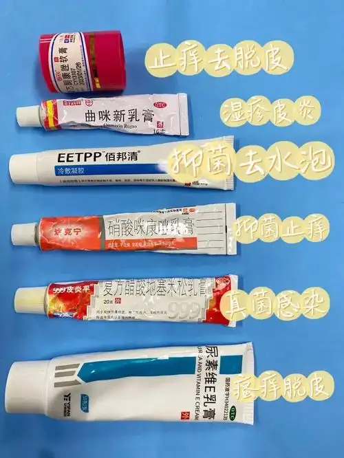 家中常备脚气药膏
