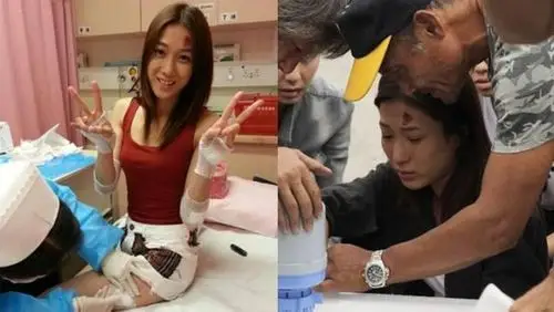 盘点十大美女惨不忍睹的受伤场面