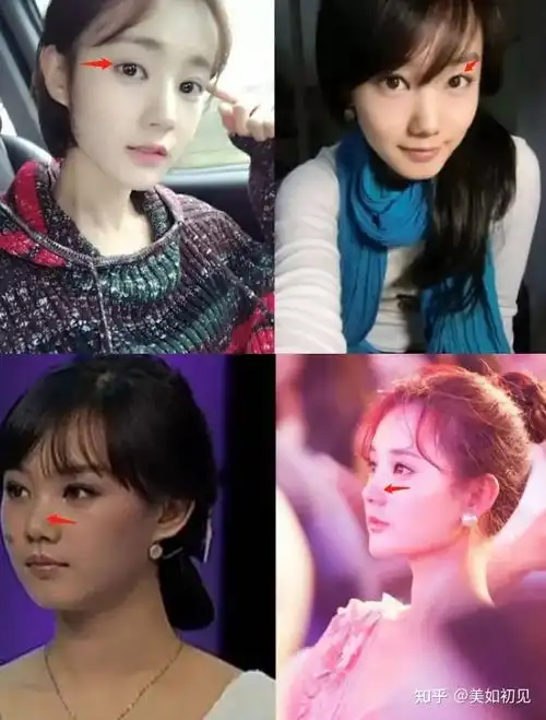 从"路人"到"颜值逆袭",这3位女明星,整容成功看不出痕迹 - 知乎
