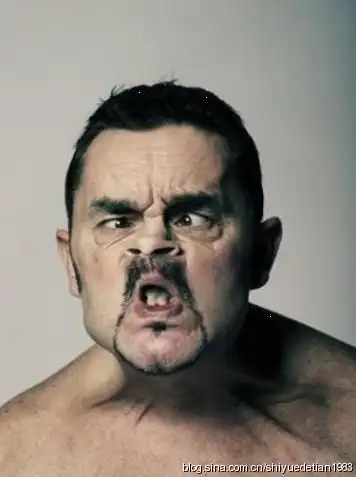 英国"丑人模特"很牛!