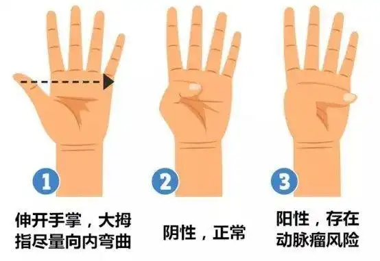 若大拇指不能超过手掌边缘(如下图),为阴性,属于正常现象;举起一只手