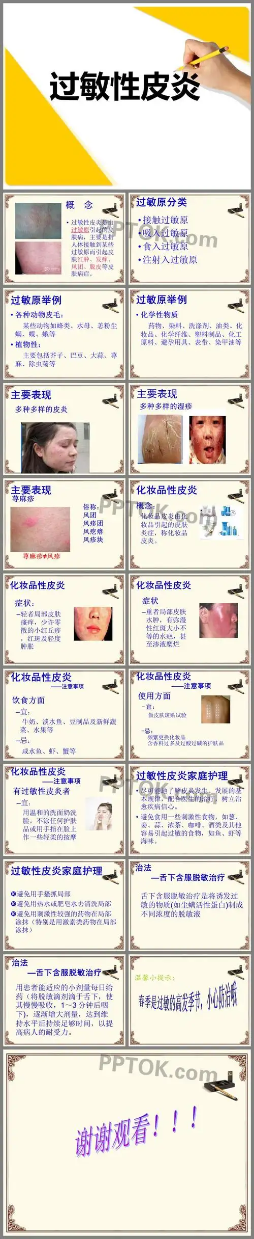 过敏性皮炎ppt课件