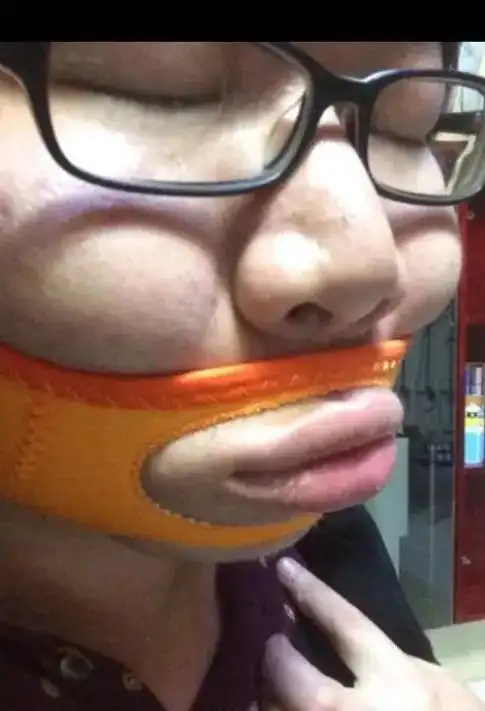 搞笑:为了提高颜值,嗷嗷哥买了瘦脸神器,来看看效果吧!