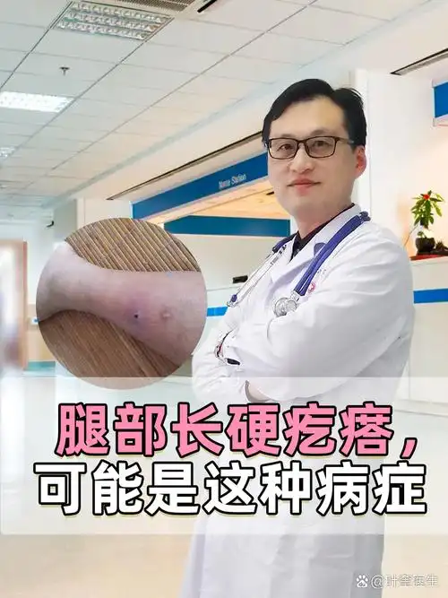 腿部长硬疙瘩,可能是这种病症 在日常生活中,可能会注意到身体上的