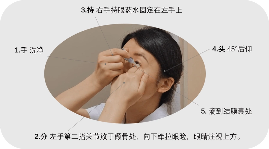 不会觉得喉咙苦苦的啦~(2)眼膏●头后仰45°,拇指和食指轻轻拉开眼睑