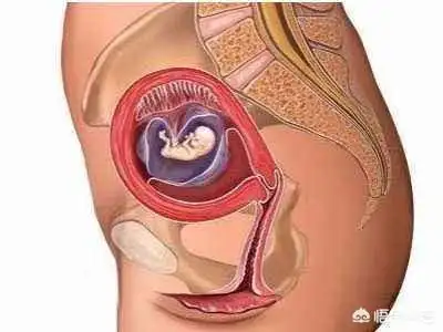怀孕12周,胎儿一直在右边是怎么回事?该不该强行纠正过来?