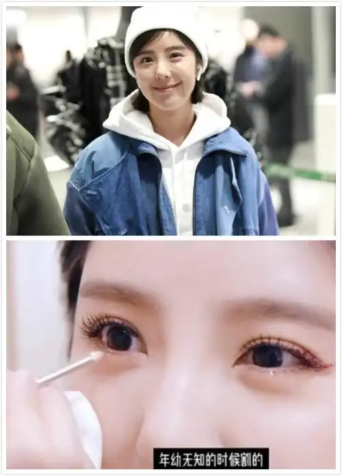 赵奕欢眼睛奇怪怎么一大一小是有一个斗鸡眼吗