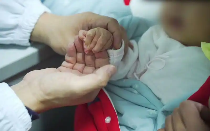 这个宝宝是马凡综合征,手指细长,中指却伸不开,治疗只能慢慢来