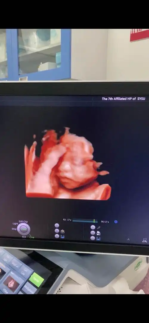 看到四维失望06鼻子太扁了不好看