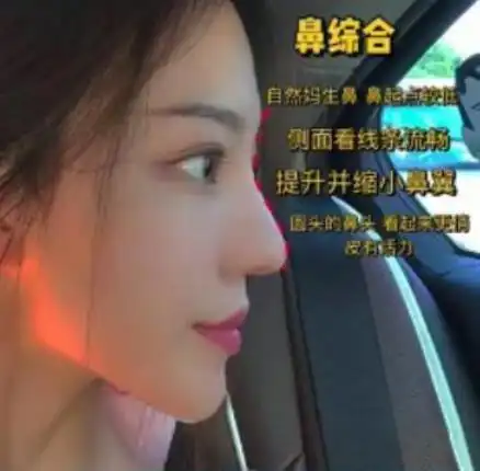 女海王项思醒整容前照片曝光,判若两人,只是想给每个男人一个家