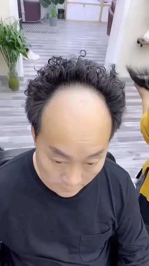 发际线高的男人有福了