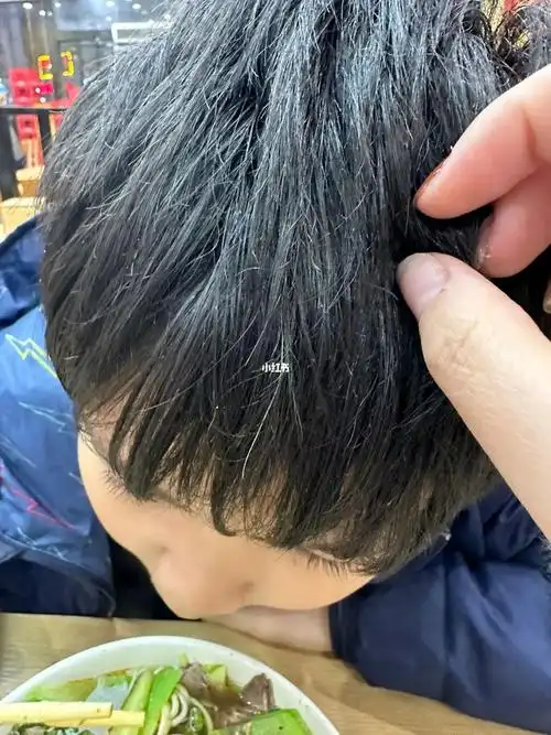 小孩都有白发了,也不知道身体是缺啥了么