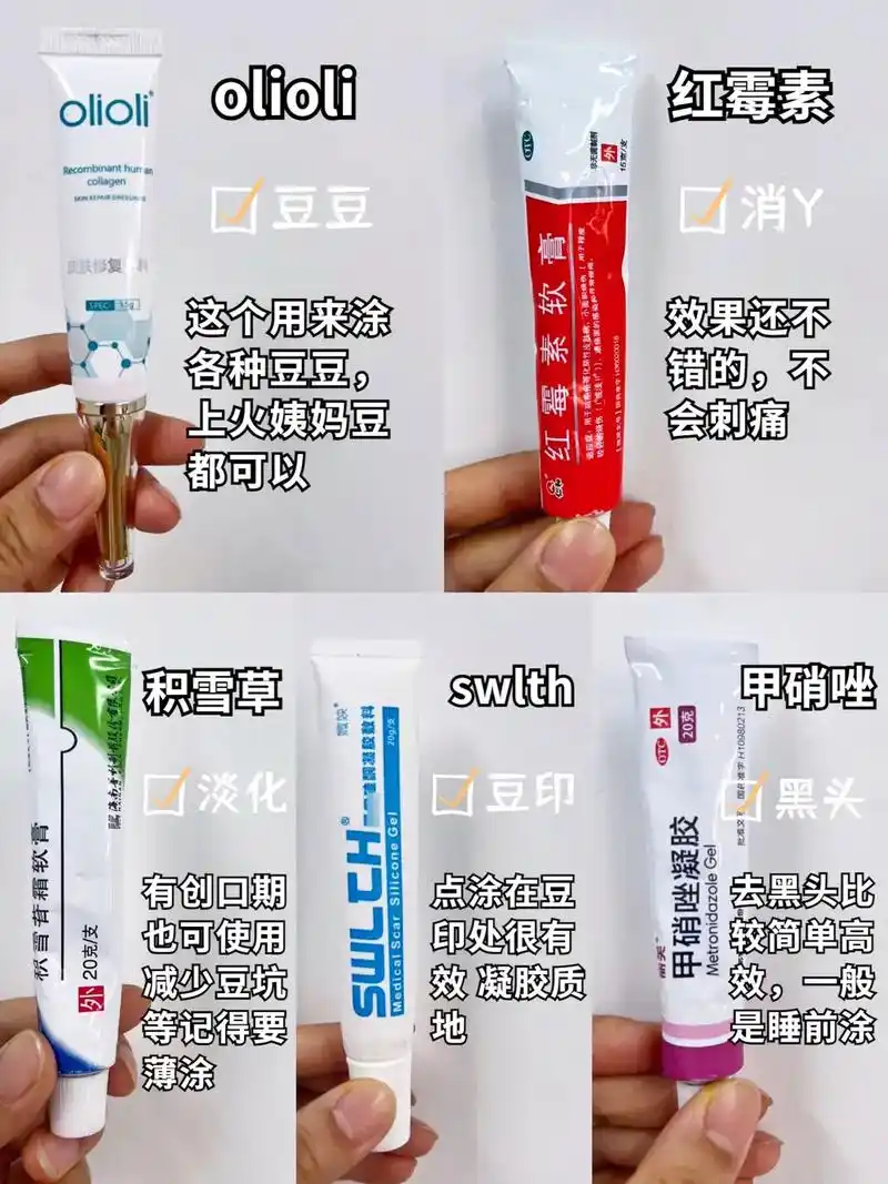 祛痘药膏合集测评!  在长痘的那段时间也没 - 抖音