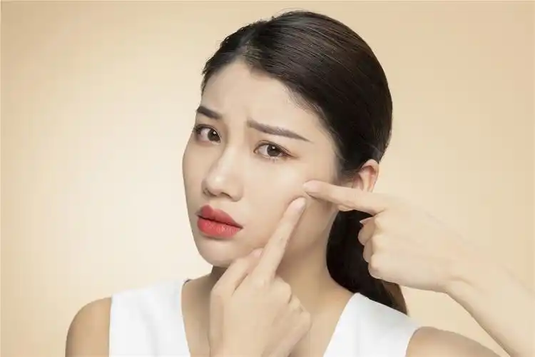 熊果素和熊果苷对皮肤有美白效果,如何给肌肤排毒?_痘痘