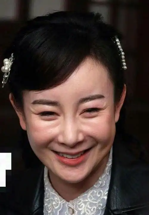 整容失败女星名单(整容失败女星盘点)(8)