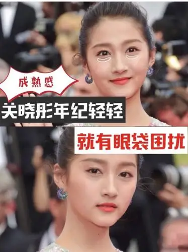 关晓彤作为97年的"_圈子-新氧美容整形