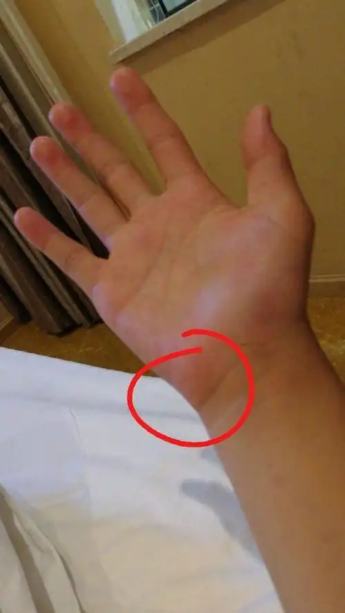 为什么我手掌那儿痛,那儿骨头随便一会扭就咯吱响