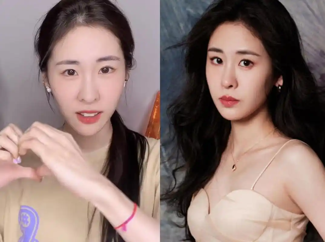 34岁张碧晨近况认不出!脸型消瘦鼻子不对称,做单亲妈妈生活快乐