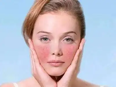 壹知肤换季不慌张关于皮肤屏障那些事你了解多少