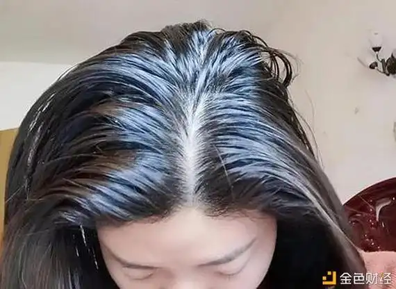 头发出油脱发怎么办