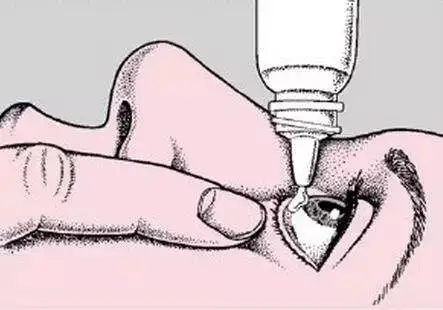 盐酸金霉素眼膏和红霉素眼膏有何区别?很多人都分不清楚