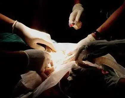 活体解剖女死刑犯实拍 - 搜狗图片搜索