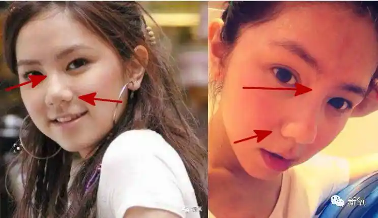 邓紫棋旧照曝光,蒜头鼻太扎眼!网友评论:除了身材哪儿都整了!