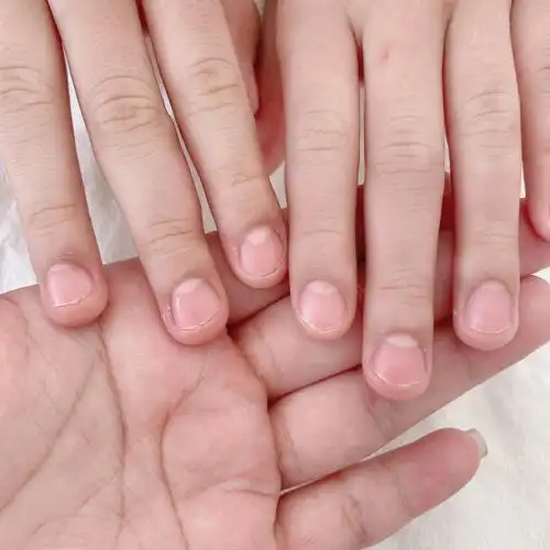 莱西孩子啃指甲怎么办学生假期来做半贴延长