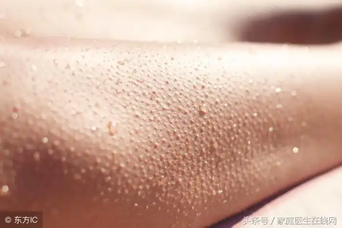 胳膊皮肤粗糙(为什么有些人手臂都是鸡皮肤)