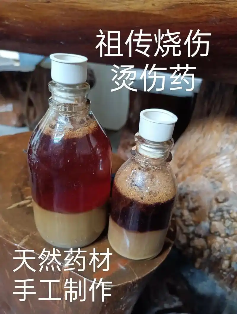 天然手制烧伤烫伤药,点心心收藏,需要的私信我 - 抖音