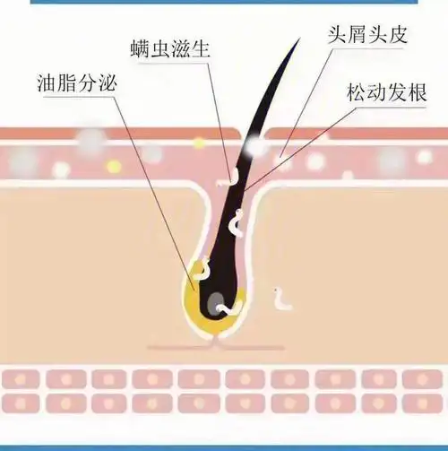 天天管头发也重视下头皮健康