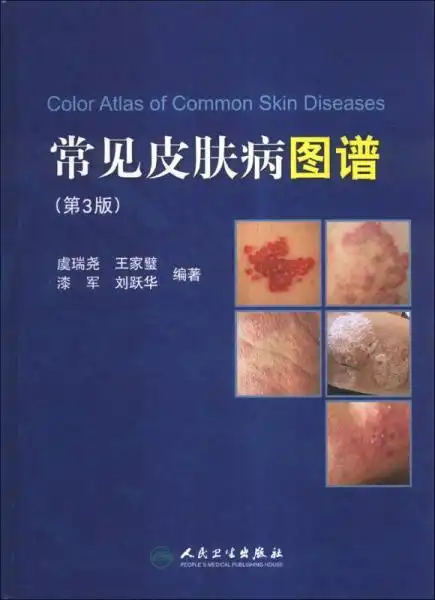 常见皮肤病图谱(第3版)