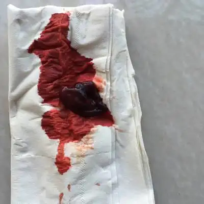 不是怀孕,下午就溜出来这样一些东西,现在我特想确定我这样是不是流产