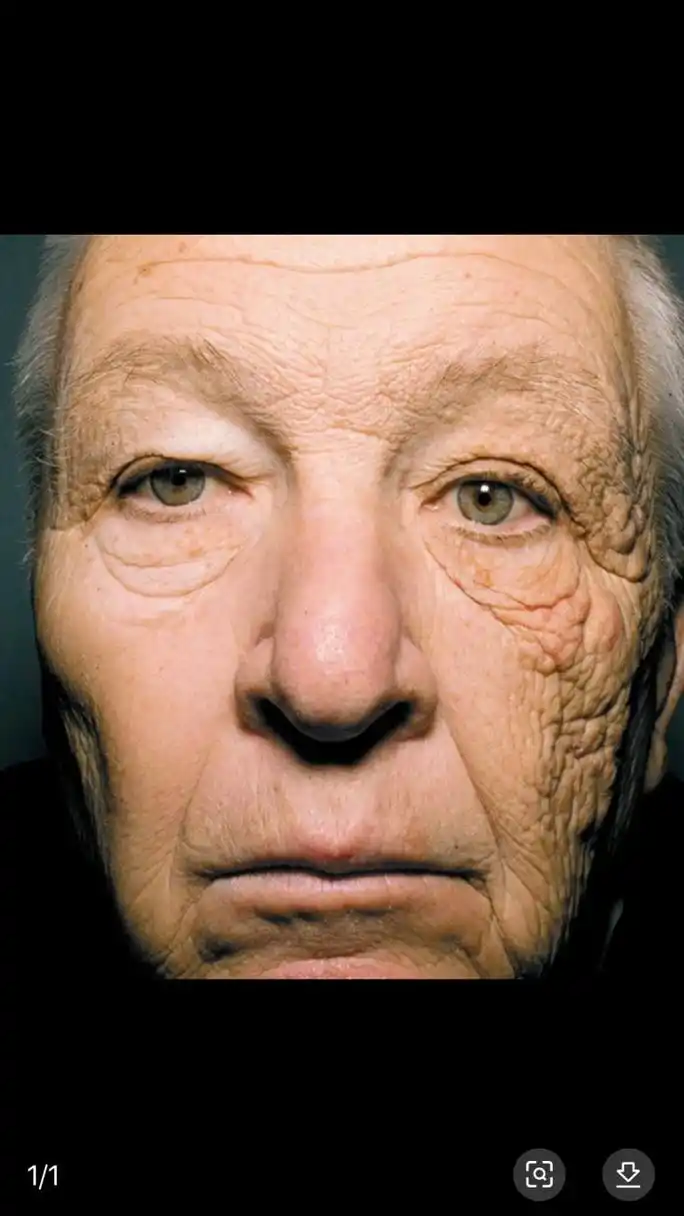 这是一个卡车司机不做防晒的脸,衰老的快 润美迪欧防晒霜清薄不油腻