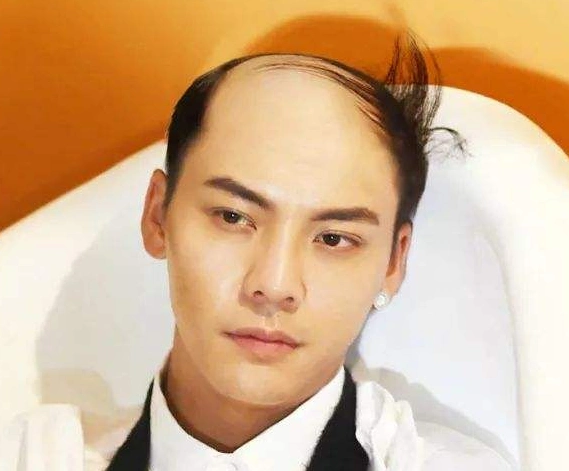 当红男星的"秃头"照片,陈伟霆最帅,看到最后那个瞬间笑尿了!