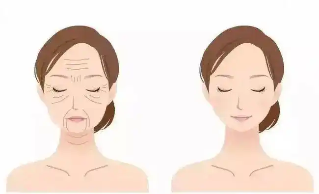 皮肤松弛_皮肤松弛介绍 - 好大夫在线