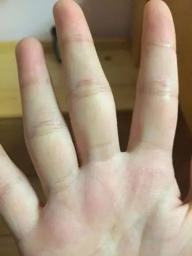 感觉我手指上黄黄的,是怎么回事啊?求解答,谢谢!