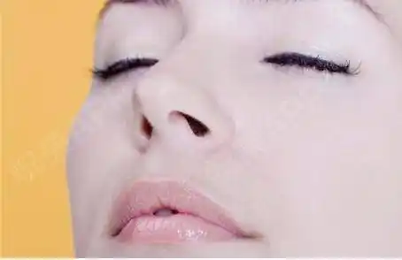 怎么让鼻梁变挺