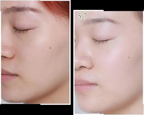 实拍记录14天快速美白!这个真的有用!