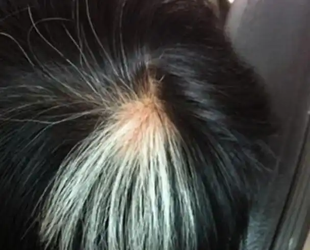 头顶出现白发也是许多年轻人会遭遇到的事情,头顶的头发一般与你的