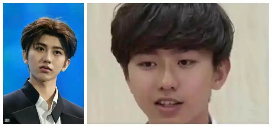 整容还是整牙蔡徐坤的颜值变化