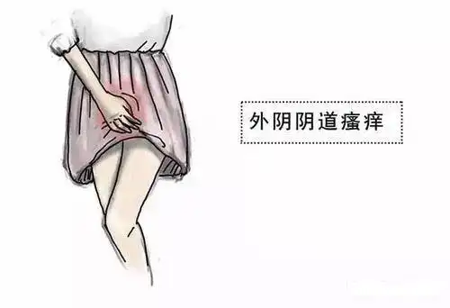 东莞长安怀孕外阴痒正常吗