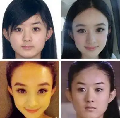 赵丽颖脸都整变形了?(前后对比图)