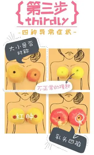 如花岁月,关爱乳腺