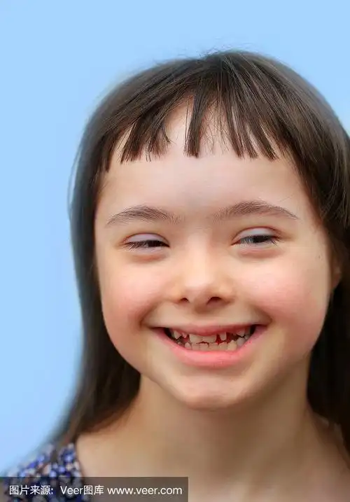 可爱的微笑唐氏综合症女孩在蓝色的背景